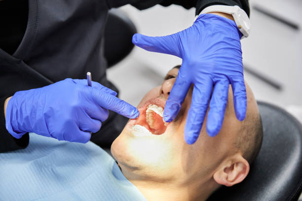Best Emergency Tooth Extraction in Spurgeon, TN